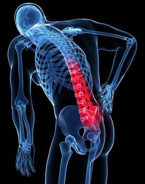 Where is lower back arthritis pain felt?